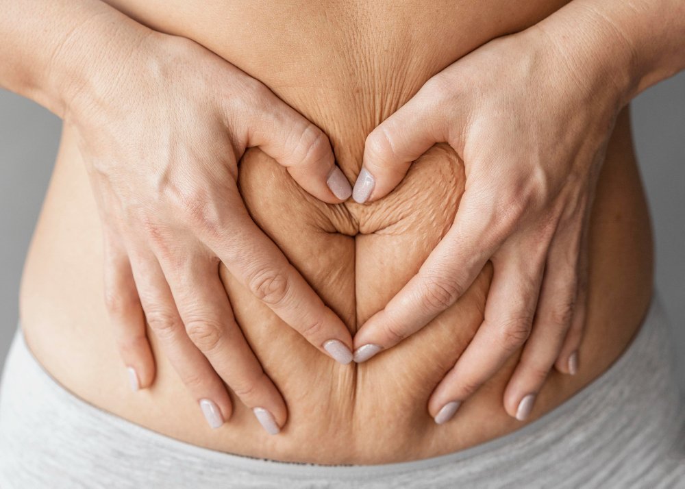 10 Powerful Ways to Prevent Loose Skin After Weight Loss - Wiser Health Prevent Loose skin after weight loss wiserhealth